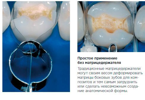 Матрицы с кольцом  пластиковые анат.ф-мы №776, KERR