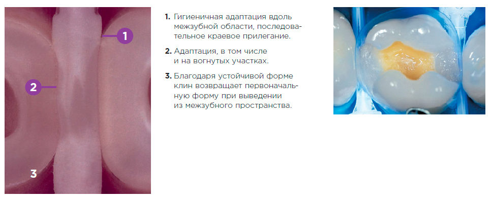 Клинья Luciwedges