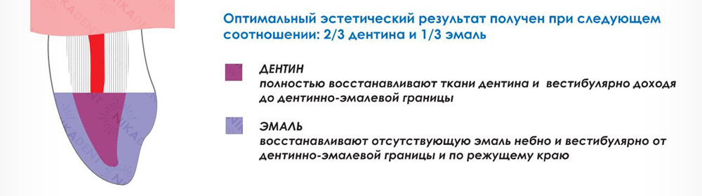 Дентлайт, композитный реставрационный материал, пакуемый, светоотверждаемый, рентгеноконтрастный. Способ применения. Дентлайт, композитный реставрационный материал, пакуемый, светоотверждаемый, рентгеноконтрастный. Способ применения.