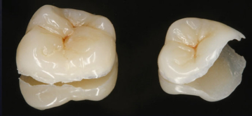 ceram.x SphereTEC Dentsply ceram.x SphereTEC Dentsply