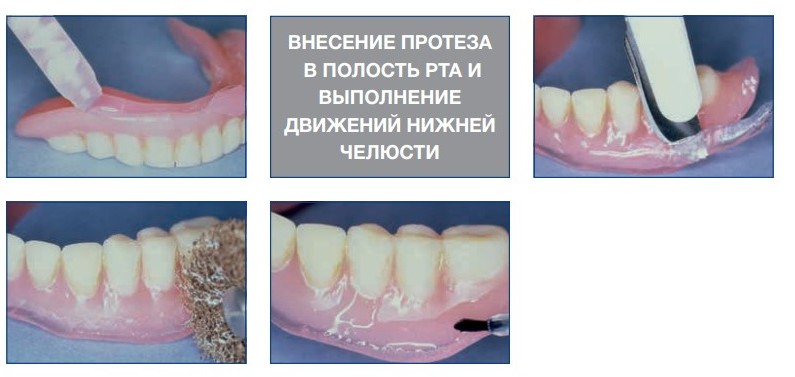 1.jpg 1.jpg