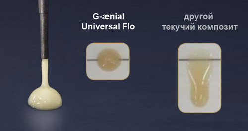 G-aenial Universal Flo - контролируемая текучесть. Оптимальная консистенция. G-aenial Universal Flo - контролируемая текучесть. Оптимальная консистенция.