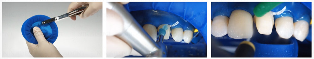 Variolink Esthetic LC, инструкция по применению Variolink Esthetic LC, инструкция по применению