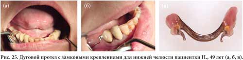 Перебазировка с использованием Tokuyama_Rebase II