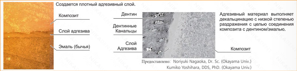 iGOS BOND - стоматологический адгезив 6 поколения iGOS BOND - стоматологический адгезив 6 поколения